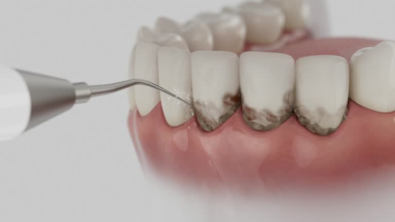 Reliable Dental contractor in Wollochet, WA by Dentist Open Now